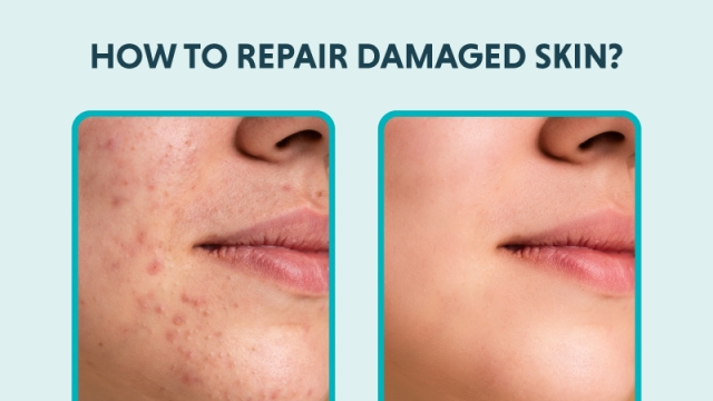 How To Fix Damaged Skin Barrier Naturally: Easy Tips