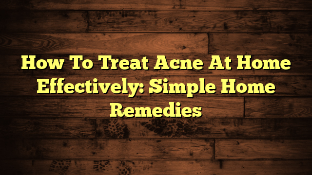 How To Treat Acne At Home Effectively: Simple Home Remedies