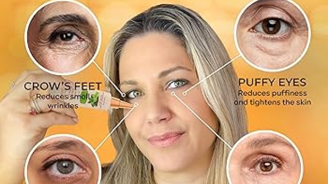 How To Reduce Eye Puffiness Naturally: Quick Home Remedies